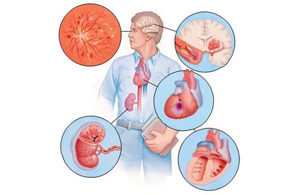 Poškození různých orgánů s prodlouženou arteriální hypertenzí